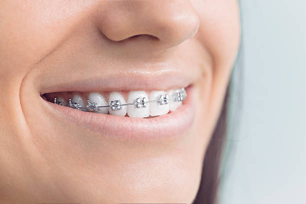 Dental Inlays and Onlays in Quanah, TX
